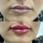  مرکز لیزر و کلینیک زیبایی محنا امین