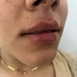 کلینیک زیبایی مارول