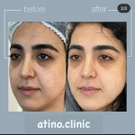 کلینیک زیبایی و مرکز لیزر آتی نو