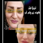  مرکز کلینیک لیزر زیبایی پوست و مو آسا