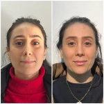  کلینیک زیبایی و مرکز لیزر آتی نو