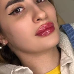 مرکز لیزر کلینیک پوست و مو فریسا