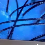 فیشال و پاکسازی تخصصی حنانه وقاری