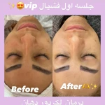  فیشال و پاکسازی تخصصی حنانه وقاری