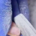 مرکز تخصصی کاشت و ترمیم ناخن