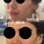 کلینیک زیبایی زرماه