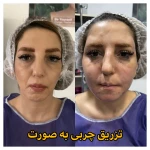 کلینیک زیبایی و لیزر موهای زائد ابریشم