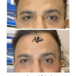  مرکز لیزر و زیبایی زروانی