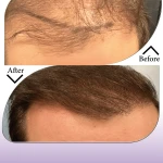 کلینیک زیبایی و بوتاکس ارکیده