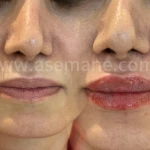  کلینیک پوست مو زیبایی و لیزر آسمانه