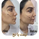 مرکز پوست و زیبایی دکتر شهلا وزیری نسب
