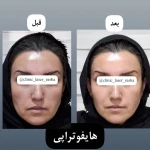 کلینیک لیزر و زیبایی راشا