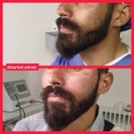 مرکز تزریق چربی و لیزر بدن شمس آباد