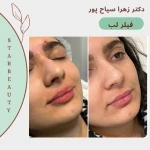  کلینیک لیزر و زیبایی پوست دکتر زهرا سیاح پور