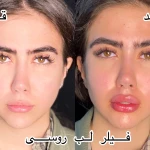 کلینیک پوست مو زیبایی دکتر نیلوفر مریمی