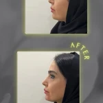 کلینیک زیبایی و مرکز لیزر آتی نو
