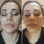 مرکز تخصصی پوست مو و زیبایی کاملیا