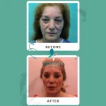 کلینیک فوق تخصصی پوست مو زیبایی و لاغری هسنس