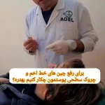 کلینیک زیبایی و لیزر کامالیزر