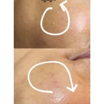  فیشال و پاکسازی تخصصی حنانه وقاری