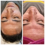  سالن تخصصی پاکسازی پوست سمیه ملکی