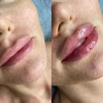 کلینیک زیبایی ملو بیوتی(تخفیف ویژه)