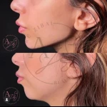  کلینیک پوست مو لیزر و لاغری عصر زیبایی