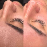  فیشال و پاکسازی پوست تخصصی بانوان نیلا