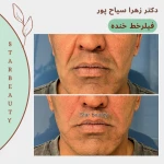  کلینیک لیزر و زیبایی پوست دکتر زهرا سیاح پور