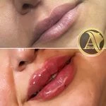 کلینیک زیبایی و مرکز لیزر آتی نو