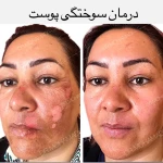  کلینیک پوست و مو ملورین  دکتر محمدی