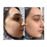  مرکز لیزر،پوست،مو و زیبایی سرو مهر