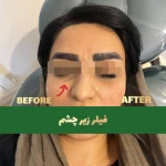  کلینیک زیبایی پوست مو لیزر اریکا