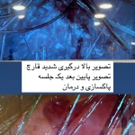 کلینیک پاکسازی و فیشیال پوست سالاری