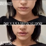 مرکز لیزر کلینیک زیبایی و بوتاکس یاسمینا
