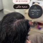 سالن تخصصی پاکسازی پوست سمیه ملکی