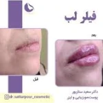  مطب پوست، مو،زیبایی و لیزر دکتر ستارپور