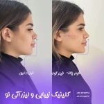  کلینیک زیبایی و مرکز لیزر آتی نو