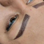  مرکز تخصصی فیشال پوست عاطفه