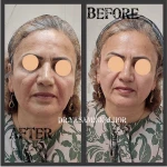 مرکز لیزر کلینیک زیبایی و بوتاکس یاسمینا