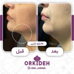  کلینیک زیبایی و بوتاکس ارکیده