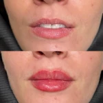  مطب پوست، مو،زیبایی و لیزر دکتر ستارپور