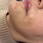 کلینیک زیبایی زرماه