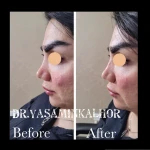 مرکز لیزر کلینیک زیبایی و بوتاکس یاسمینا