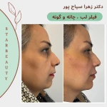 کلینیک لیزر و زیبایی پوست دکتر زهرا سیاح پور