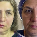 کلینیک پوست مو زیبایی و لیزر آسمانه