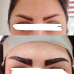 مرکز تزریق چربی و لیزر بدن شمس آباد