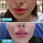  کلینیک زیبایی و لیزر کامالیزر
