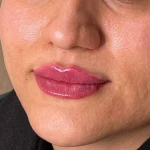  مرکز لیزر و زیبایی زروانی
