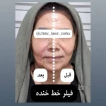 کلینیک لیزر و زیبایی راشا